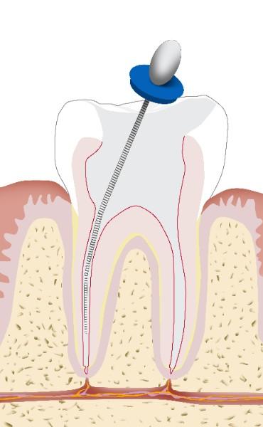 Santé bucco-dentaire