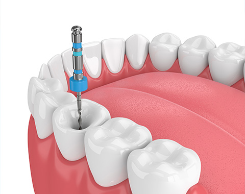 Endodontie